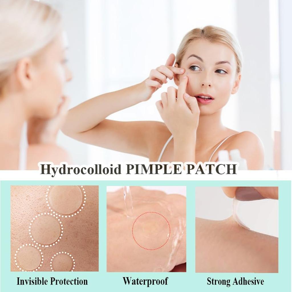 Zemolo 300pcs Pimple Patches Spot Patches Acne Hydrocolloid Salicylic Acid, Acne Absorbing Invisible Stickers，Cover Dot for Pimples Whiteheads Day & Night