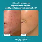 Paula's Choice SKIN PERFECTING 2% BHA Liquid Exfoliant - Face Exfoliating Peel Fights Blackheads & Enlarged Pores - for a Healthy Glow - with Salicylic Acid - Combination & Oily Skin - 30 ml