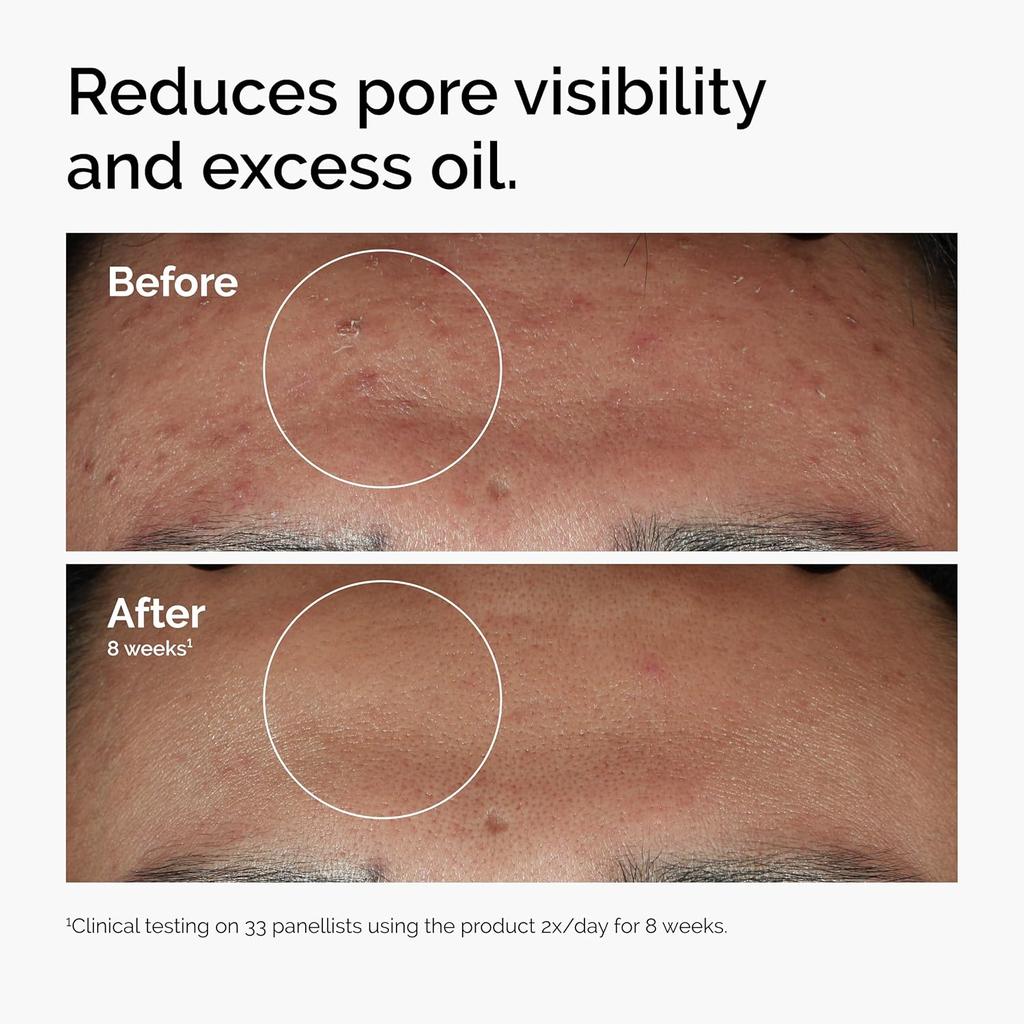 The Ordinary Niacinamide 10% + Zinc 1% 30 ml