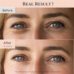 Beauty of Joseon Revive Eye Serum Retinal Niacinamide Peptide Cream, Corrector for Puffy Dark Circles, Fine Lines, Dark Circles and Wrinkles, Korean Skin Care, 30 ml